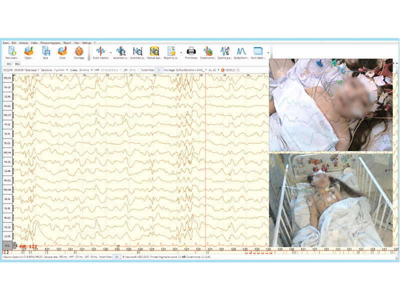 Neuron-Spectrum-Video pentru Neuron Spectrum 5-1